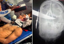 Adolescente apuñala a un joven en la cabeza por una deuda en La Guaira