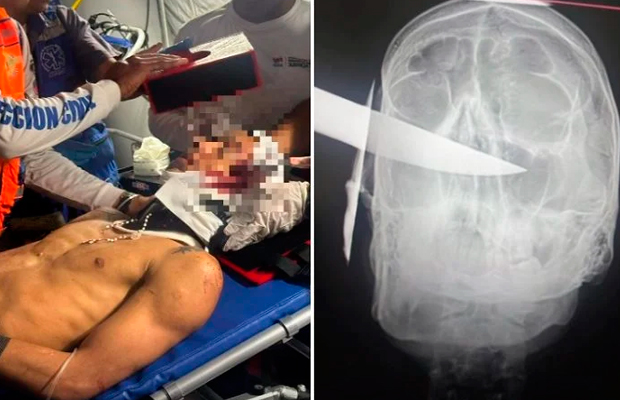 Adolescente-apuñala-a-un-joven-en-la-cabeza-por-una-deuda-en-La-Guaira