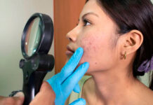 Sociedad Venezolana de Dermatología alerta sobre riesgos de seguir consejos de salud emitidos por influencers